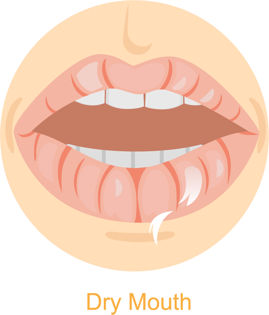 Dry Mouth Island Tower Dentistry