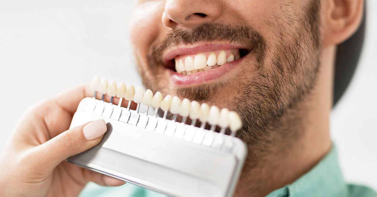 veneers vs other treatments blog